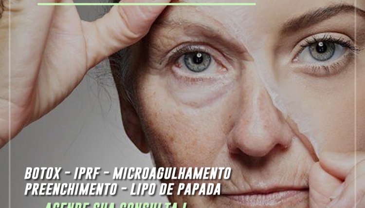 Umuprev Cafelândia informa sobre a harmonização orofacial no resgaste da autoestima