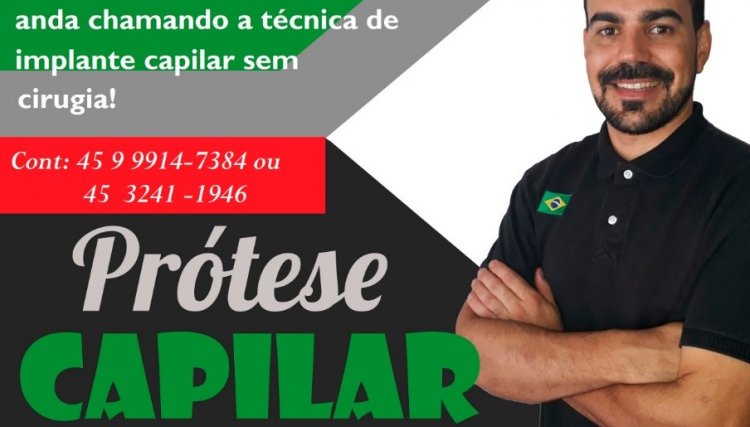 Salão Ideal de Cafelândia conta com especialista em prótese capilar
