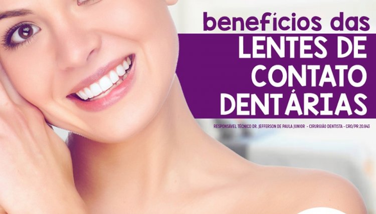 Lentes de contato dentárias é na Orthodent
