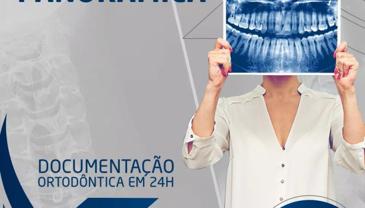 Nova X oferece tecnologia e precisão nos exames