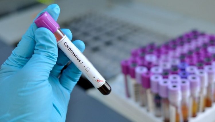Paraná soma 258 casos e quatro óbitos por coronavírus